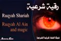 Ruqyah according to the Quran and Sunnah to treat witchcraft, and the evil eye