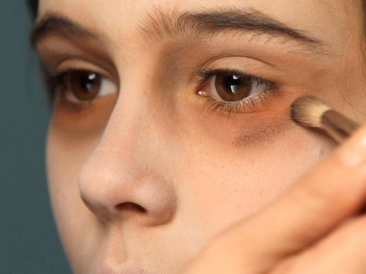 اسباب ظهور الهالات السوداء تحت العيون وطرق علاجها